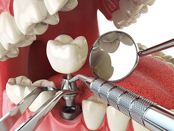 Best Tooth Infection Emergency Dentist  in South Hutchinson, KS